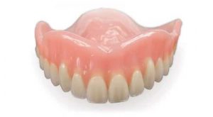 implant dentures rendering molding